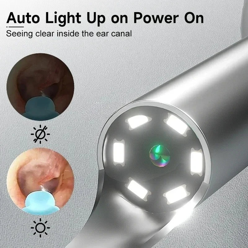 WiFi Visual Ear Cleaner with HD Camera – 1080P Wireless Ear Cleaning Endoscope